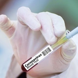 Covid, dalla Regione 10 milioni di euro per potenziare i laboratori e sviluppare progetti di ricerca