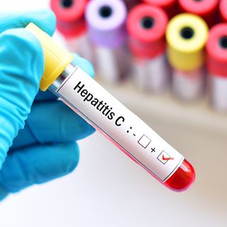 Epatite C, attivo in tutto il Piemonte lo screening per la ricerca del virus
