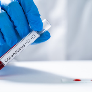Primo caso in Piemonte di variante svizzera, colpito un 57enne re-infettato