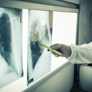 Lotta ai tumori dopo il Covid: "La gente deve ricominciare a fare screening, ma servono anche specialisti" VIDEO