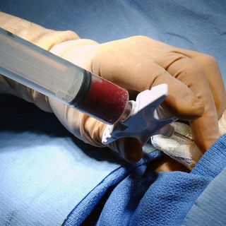 Molinette, intervento miracoloso: trapianto di cuore da un giovane donatore con l'organo &quot;revitalizzato&quot;.