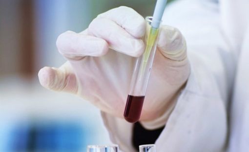 Vaiolo delle scimmie, individuato un caso in Piemonte Vaiolo delle scimmie, individuato un caso in Piemonte