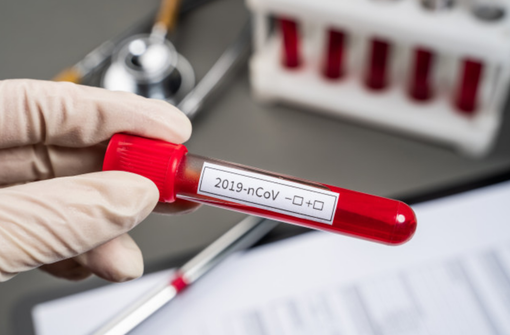 In Piemonte 717 nuovi casi di persone contagiate In Piemonte 717 nuovi casi di persone contagiate