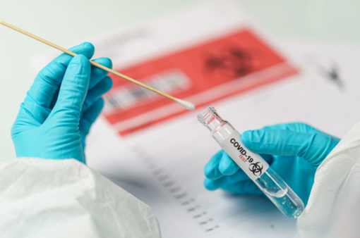 Covid in Piemonte, il contagio cresce soprattutto tra gli over 70 Covid in Piemonte, il contagio cresce soprattutto tra gli over 70