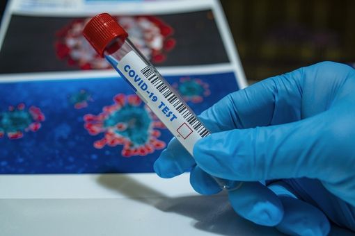 Covid, da oggi operativo il nuovo numero regionale per chiedere informazioni Covid, da oggi operativo il nuovo numero regionale per chiedere informazioni