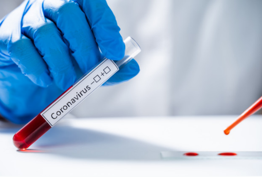 Primo caso in Piemonte di variante svizzera, colpito un 57enne re-infettato