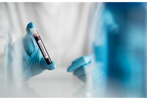 Oltre 100 pazienti dimessi dai reparti Covid e 667 nuovi casi positivi