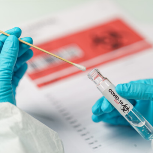 Covid in Piemonte, il contagio cresce soprattutto tra gli over 70