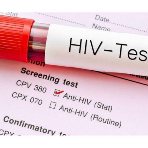Giornata mondiale lotta all’Aids, nel Vco 6 nuovi casi di sieropositività tra gli over 40