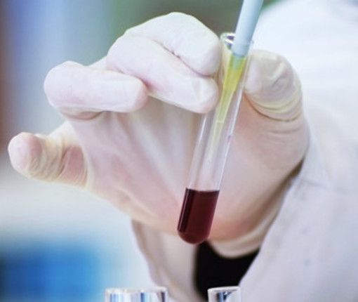 Vaiolo delle scimmie, individuato un caso in Piemonte