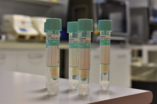 La &quot;sorella&quot; di Omicron in Ticino, il medico: &quot;Non chiamatela variante, resta sorvegliata&quot;