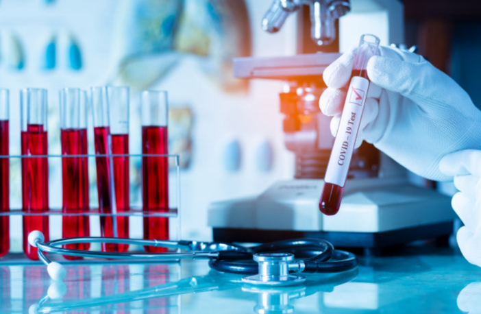 Il 'long Covid' potrebbe colpire una persona su quattro fra quelle che si sono ammalate Il 'long Covid' potrebbe colpire una persona su quattro fra quelle che si sono ammalate