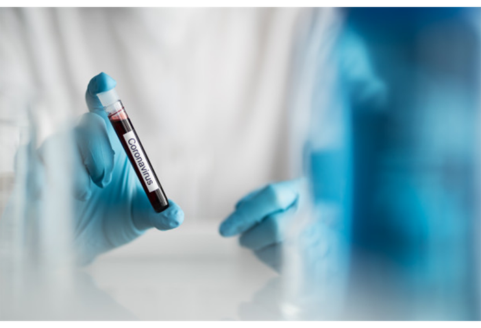 Oltre 100 pazienti dimessi dai reparti Covid e 667 nuovi casi positivi Oltre 100 pazienti dimessi dai reparti Covid e 667 nuovi casi positivi