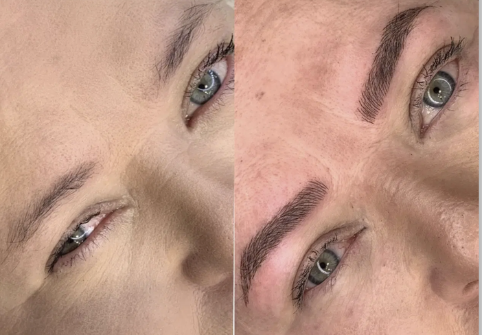 Tricopigmentazione Tricopigmentazione