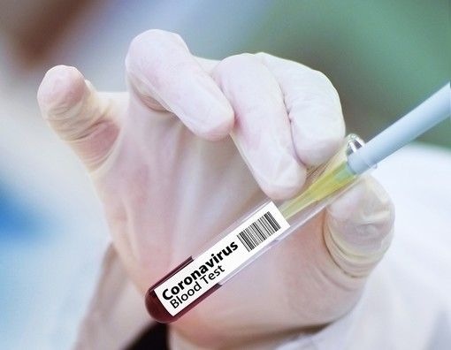 Covid, salgono a 212.306 i pazienti guariti da inizio pandemia in Piemonte Covid, salgono a 212.306 i pazienti guariti da inizio pandemia in Piemonte