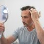 Stempiatura fisiologica o alopecia androgenetica: cosa distingue le due condizioni