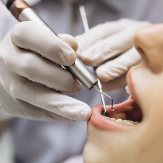 Odontotecnici ad un passo dalla svolta: vicino il riconoscimento come professionisti sanitari