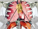 Intervento innovativo alle Molinette: salvato un uomo con una massa tumorale di 10x10 cm sopra il cuore