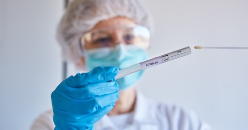 Coronavirus in Piemonte, nell'ultima settimana 2887 casi medi giornalieri Coronavirus in Piemonte, nell'ultima settimana 2887 casi medi giornalieri