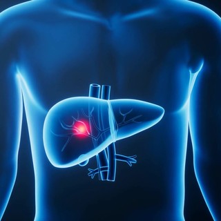Giornata epatiti, esperti 'terapie efficaci, screening di prossimità per le virali'
