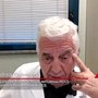 Salute, Galimberti (LICE): "L'epilessia è una patologia neurologica, non psichiatrica"