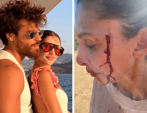 Can Yaman, la fidanzata Sara Bluma denuncia le violenze dell'ex. L'attore: &quot;Ti amo&quot;