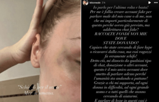 Rapper Faneto sotto accusa, l'ex fidanzata pubblica foto e messaggi di violenza