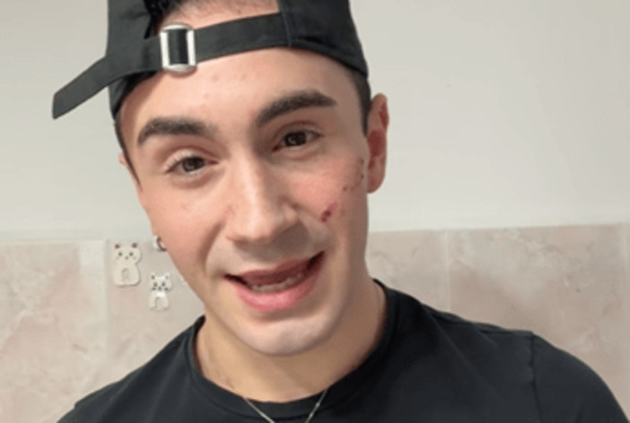 Genova, 19enne denuncia aggressione omofoba: "Sfregiato al viso con coltellino" Genova, 19enne denuncia aggressione omofoba: "Sfregiato al viso con coltellino"