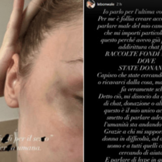 Rapper Faneto sotto accusa, l'ex fidanzata pubblica foto e messaggi di violenza Rapper Faneto sotto accusa, l'ex fidanzata pubblica foto e messaggi di violenza