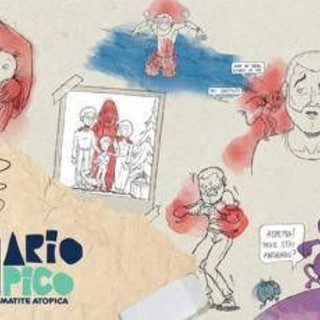 Dermatite atopica, oltre 1,3 mln di persone hanno visto il corto 'Diario atipico' Dermatite atopica, oltre 1,3 mln di persone hanno visto il corto 'Diario atipico'