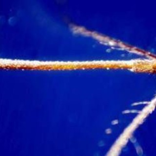 West Nile, quarta vittima nel Lazio: morta 93enne
