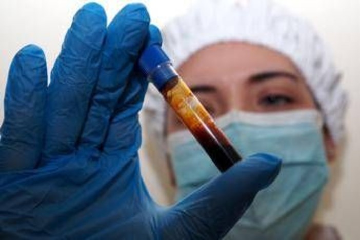 Hantavirus, negativo il turista inglese in quarantena a Milano. Test per una donna ricoverata a Messina Hantavirus, negativo il turista inglese in quarantena a Milano. Test per una donna ricoverata a Messina