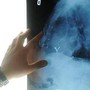 Radiologia interventistica, Ssn e fondazioni per cure più accessibili
