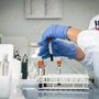 Miastenia gravis, al via studio su qualità di vita e impatto socio-sanitario Miastenia gravis, al via studio su qualità di vita e impatto socio-sanitario