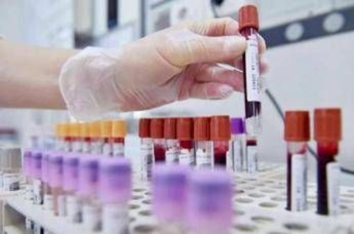 Allarme oncologi: "- 50% trial in Europa in 10 anni mentre Cina accelera" Allarme oncologi: "- 50% trial in Europa in 10 anni mentre Cina accelera"