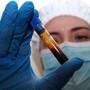 Hantavirus, negativo il turista inglese in quarantena a Milano. Test per una donna ricoverata a Messina