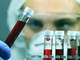 Tumori, Ue approva terapia per adulti con leucemia linfatica cronica refrattaria