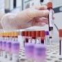 Alert su difterite in Ue, l'infezione continua a colpire in Europa