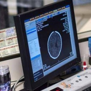 Salute, Padovani (Sin): "Longevità aumenta rischio Alzheimer, agire su prevenzione" Salute, Padovani (Sin): "Longevità aumenta rischio Alzheimer, agire su prevenzione"