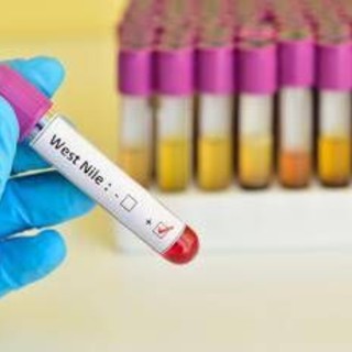 West Nile, quarta vittima in Campania: muore un 73enne