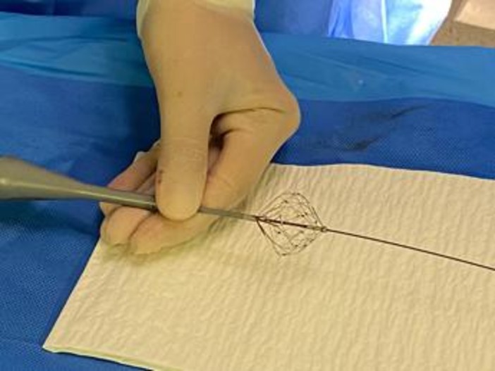 Fibrillazione atriale, Aou Marche: "Prima volta in Italia ablazione con catetere a campo pulsato" Fibrillazione atriale, Aou Marche: "Prima volta in Italia ablazione con catetere a campo pulsato"