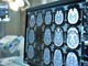 Giornata mondiale dell'Alzheimer, neurologi: &quot;Ora percorsi cura più efficaci e sostenibili&quot;