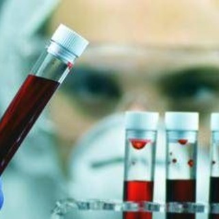 Salute, da Fedemo appello per autosufficienza nazionale sangue e plasmaderivati Salute, da Fedemo appello per autosufficienza nazionale sangue e plasmaderivati