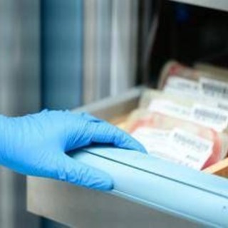 Leucemia linfatica cronica, speranze da nuova terapia mirata&amp;nbsp;