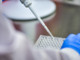 Aifa approva il rimborso di risankizumab per colite ulcerosa Aifa approva il rimborso di risankizumab per colite ulcerosa