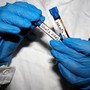 Hantavirus, Ema monitora diffusione: "Pronti a supportare iter vaccini"