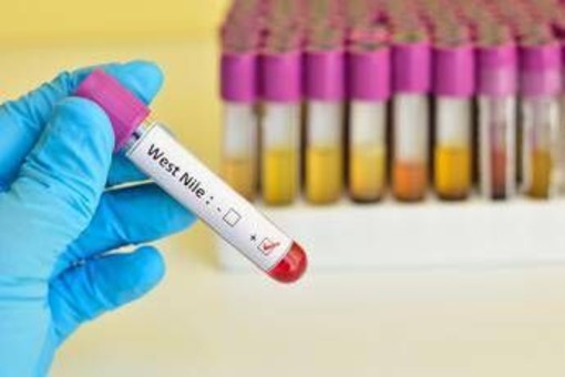 West Nile, quarta vittima in Campania: muore un 73enne